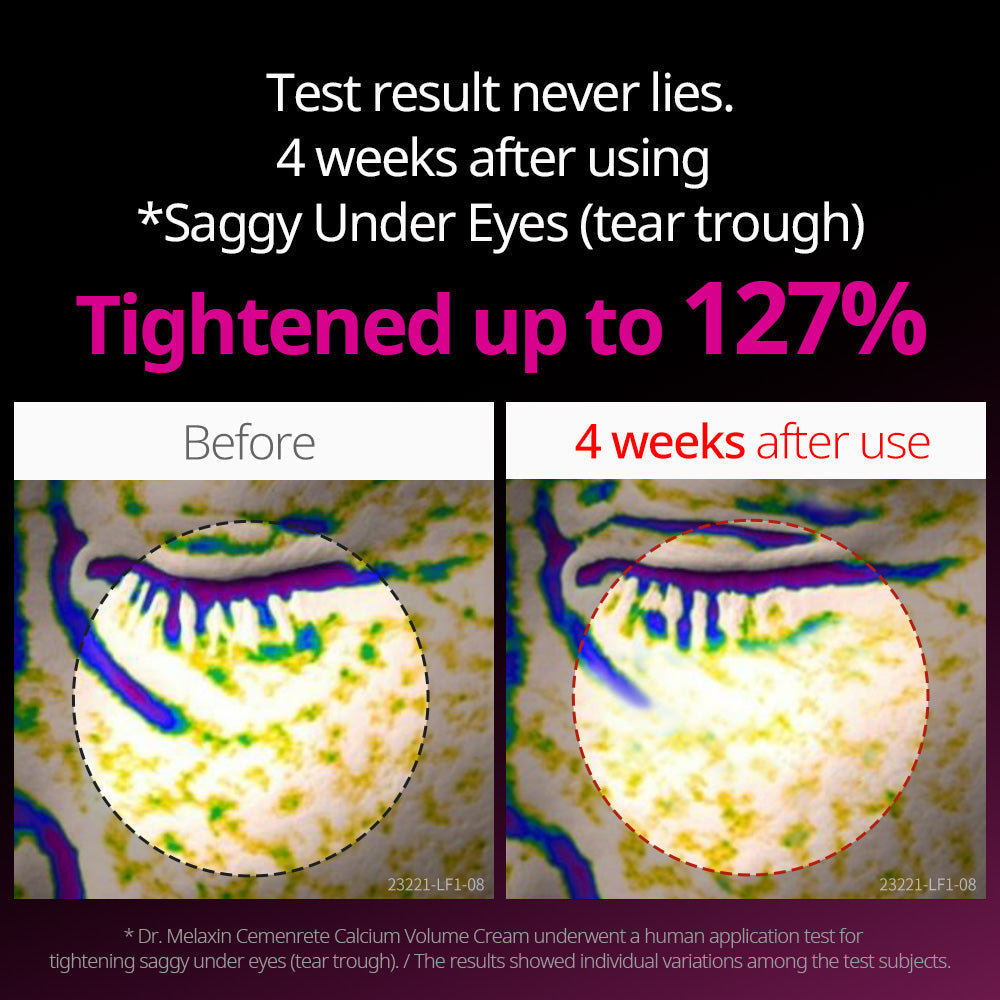 Calcium Intense Cream