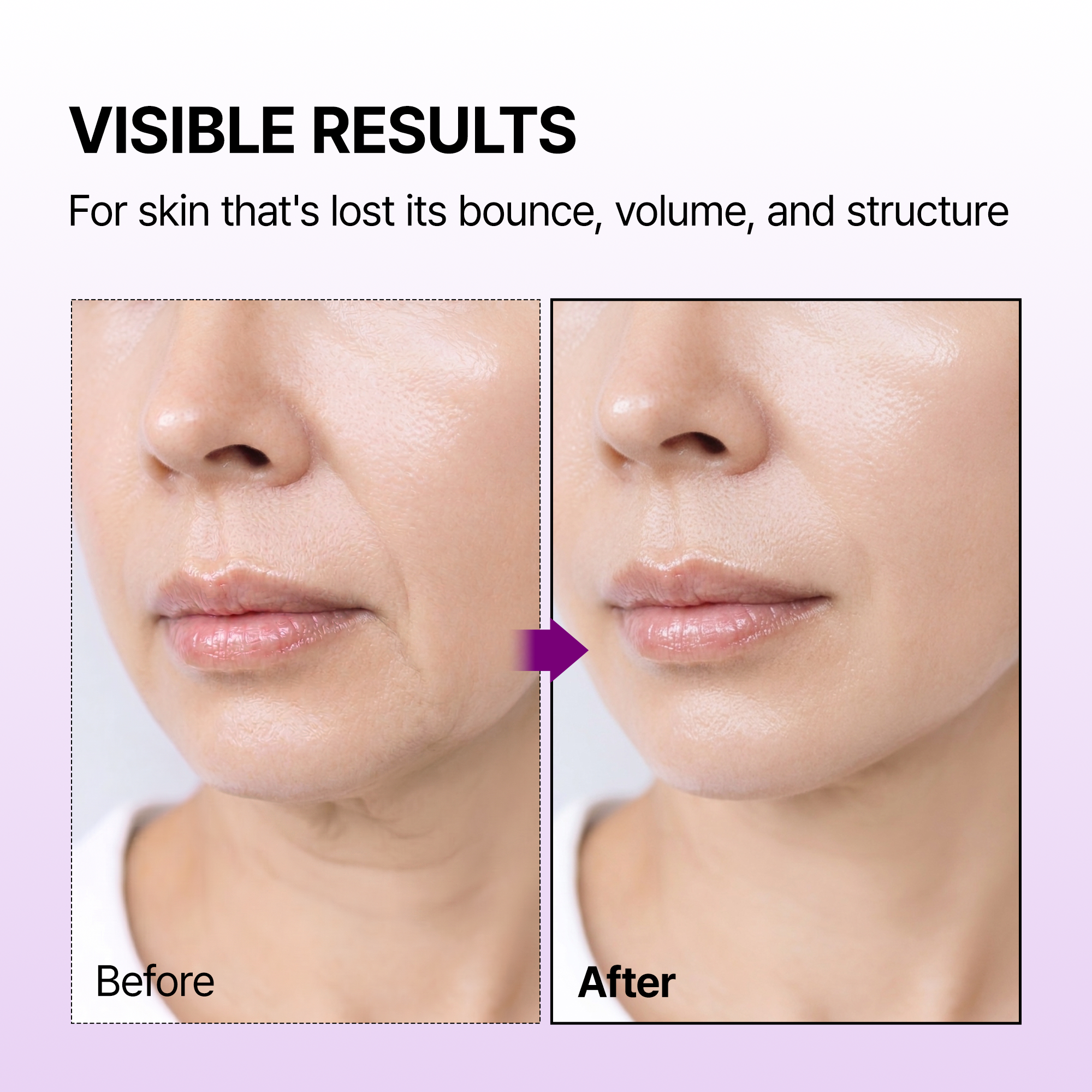 Calcium Bonding Facial Cream