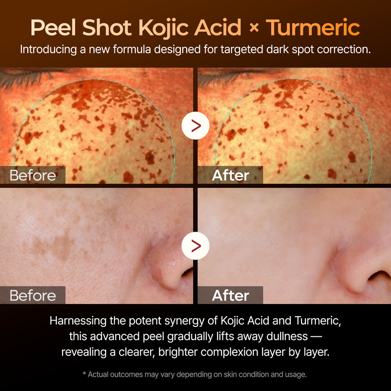 Kojic Acid Turmeric Brightening Routine Duo
