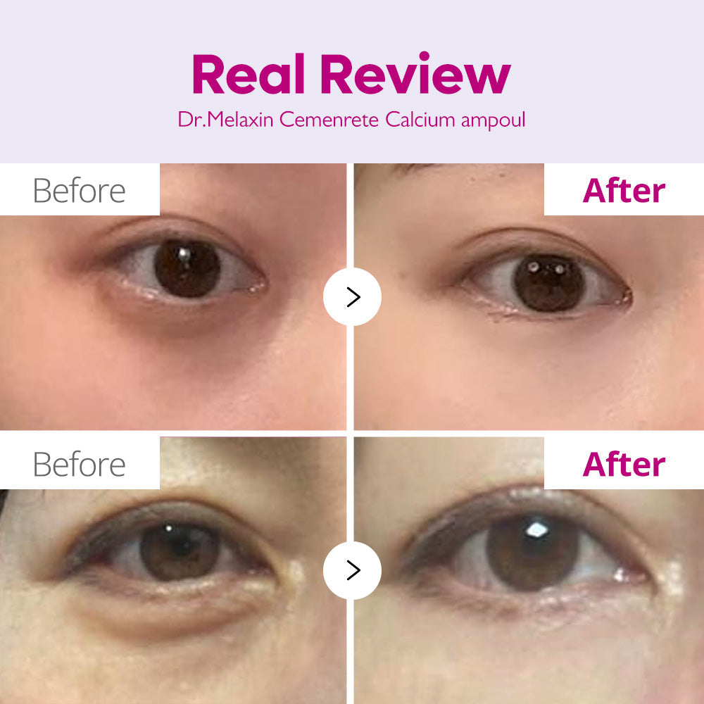 Calcium Intense Ampoule Plus