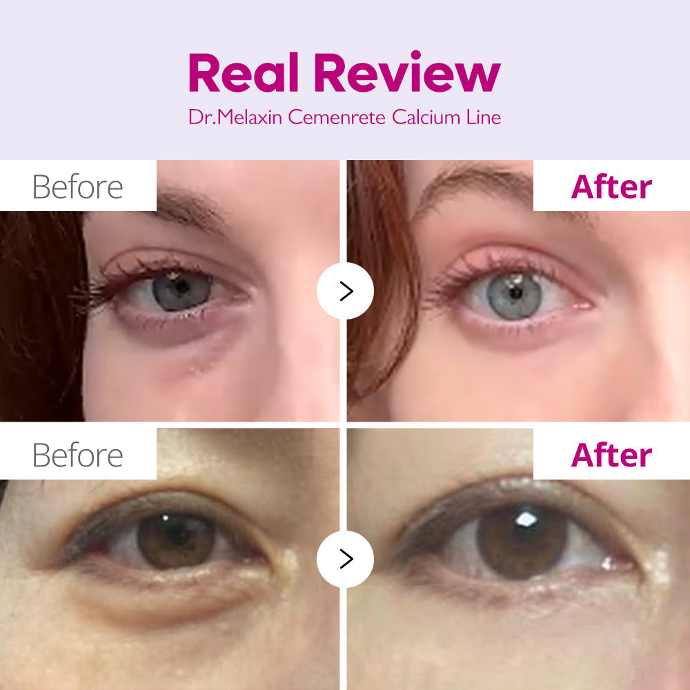 Calcium Collagen Calcium Eye Care Line
