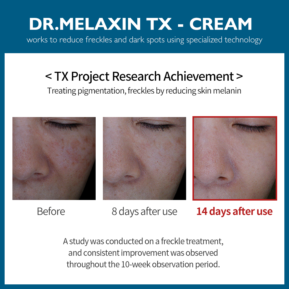 4-Step TX Brightening Essentials Set