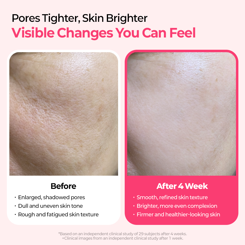 Cyano Pink Spicule Serum