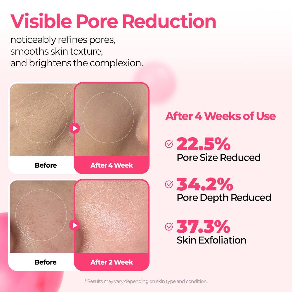 Cyano Pink Spicule Serum