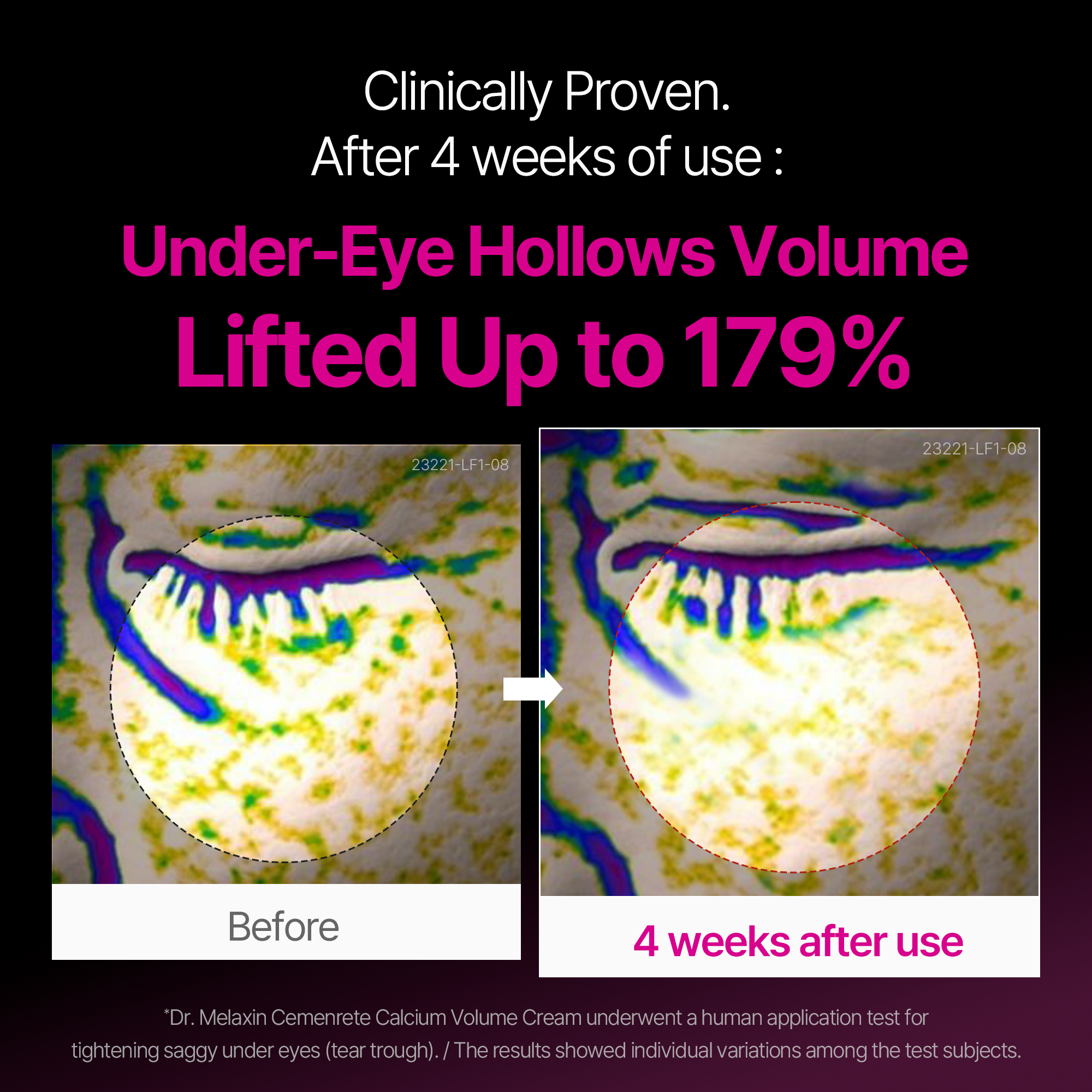 Eyephalt Day & Night Firming Routine Set