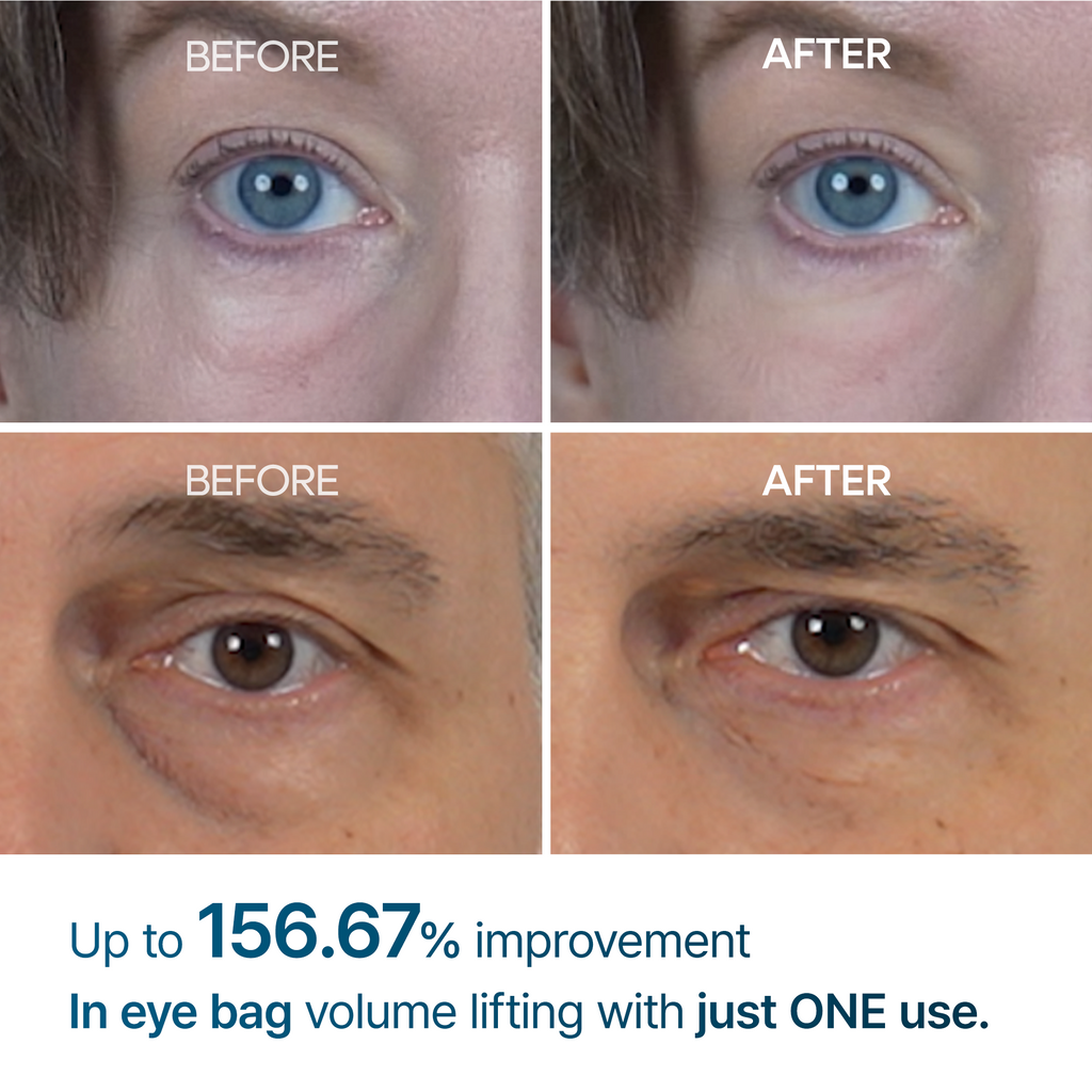 Summer Essentials  | Eye & Firming Essentials