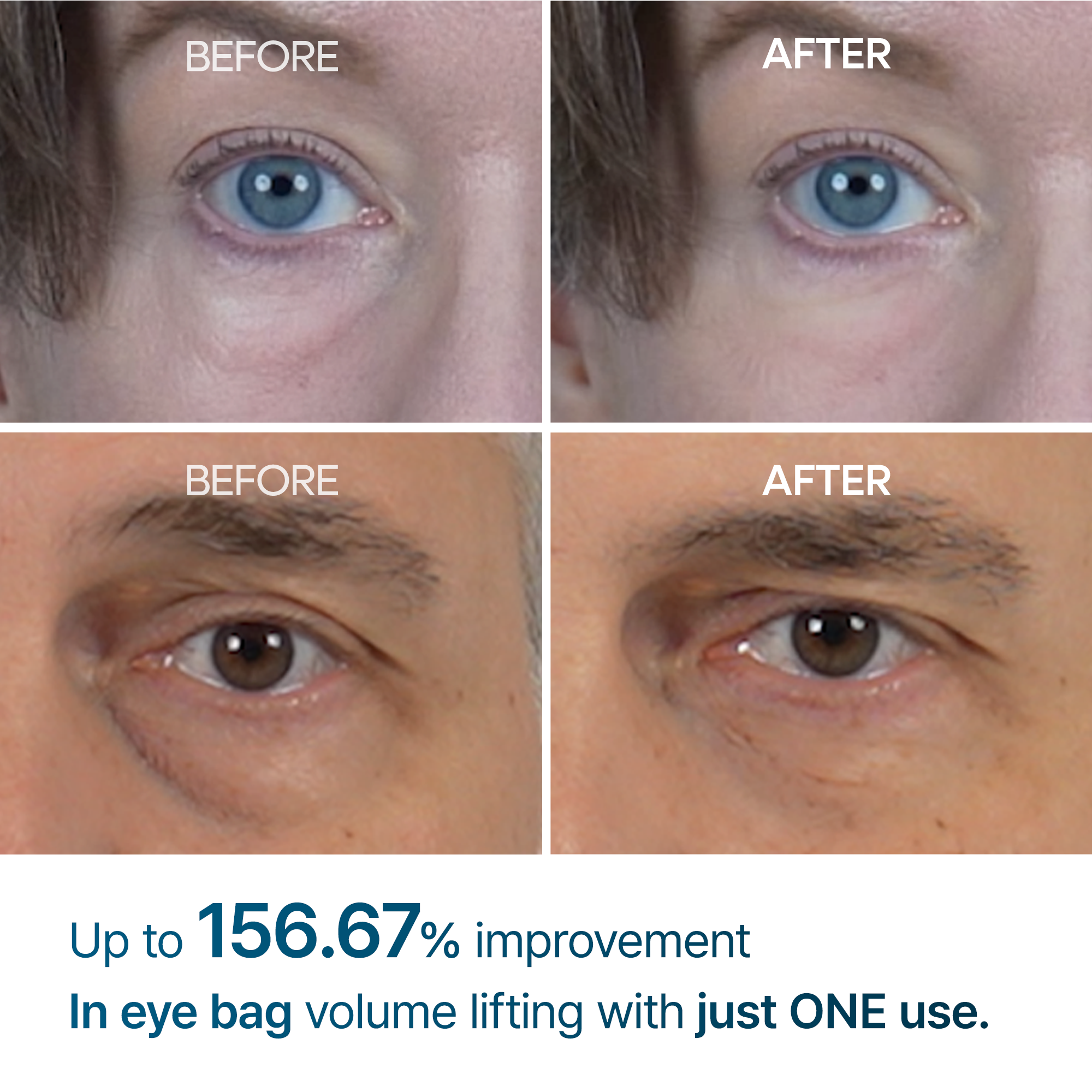 Eyephalt Day & Night Firming Routine Set