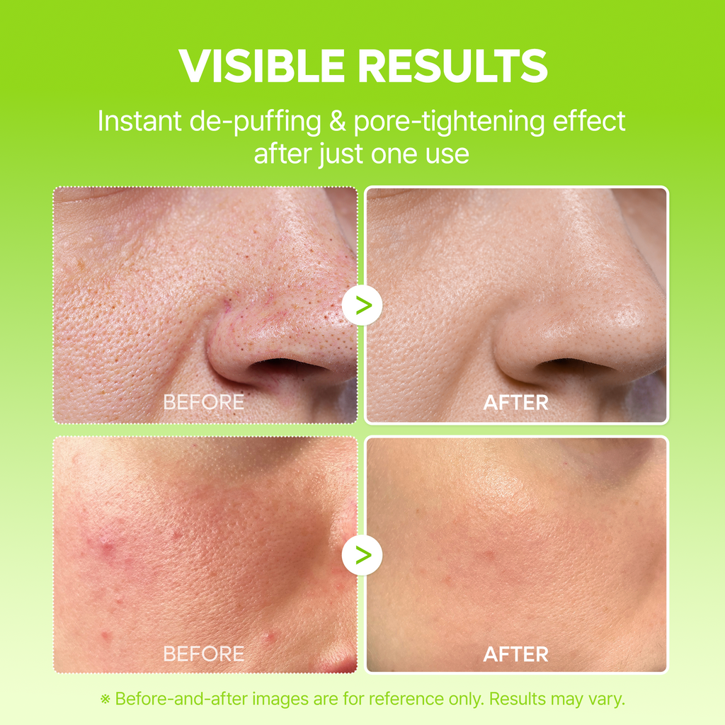 Summer Exclusive | 10-Step Skin Renewal Routine Set