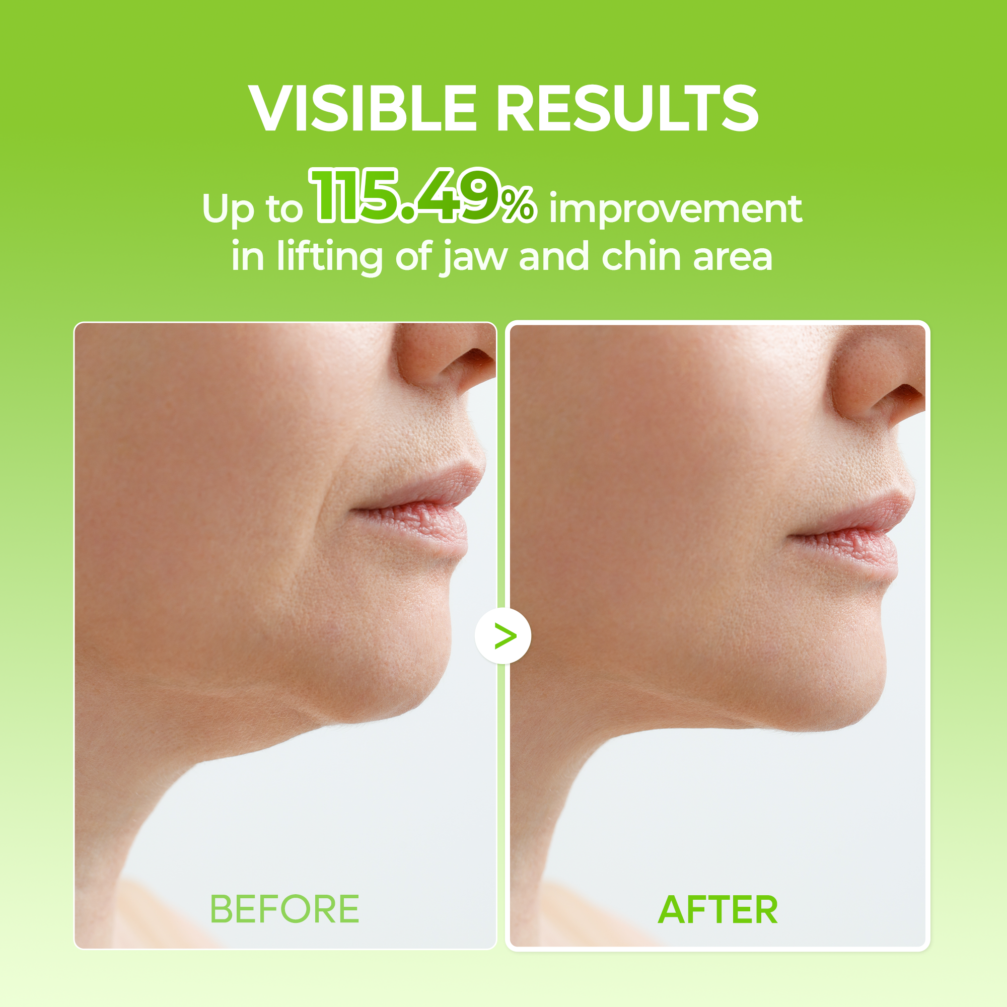 3-Step CACTOX Pore Tightening Set