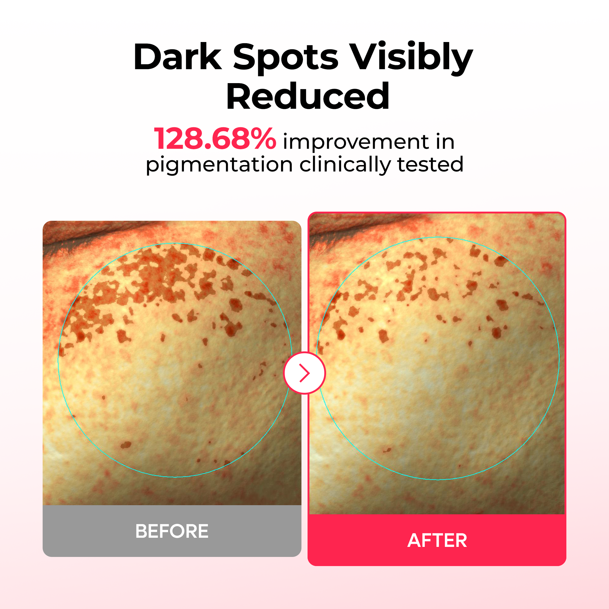 TX Astaxanthin Dark Spot Care Hydrogel Mask 4EA