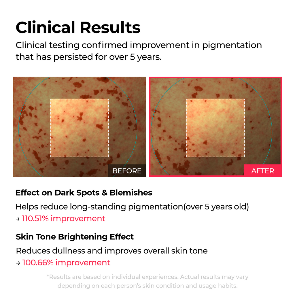 Summer Exclusive | 10-Step Skin Renewal Routine Set